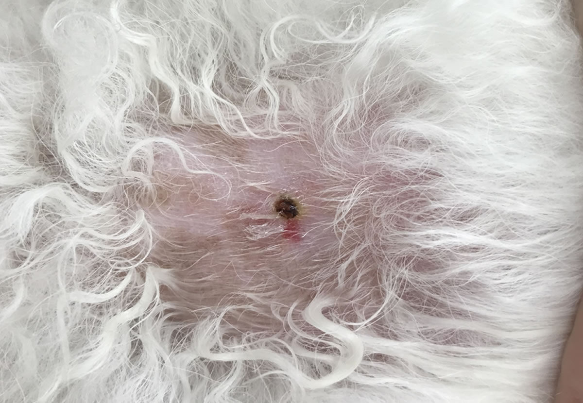 単発のイボ(良性)手術後