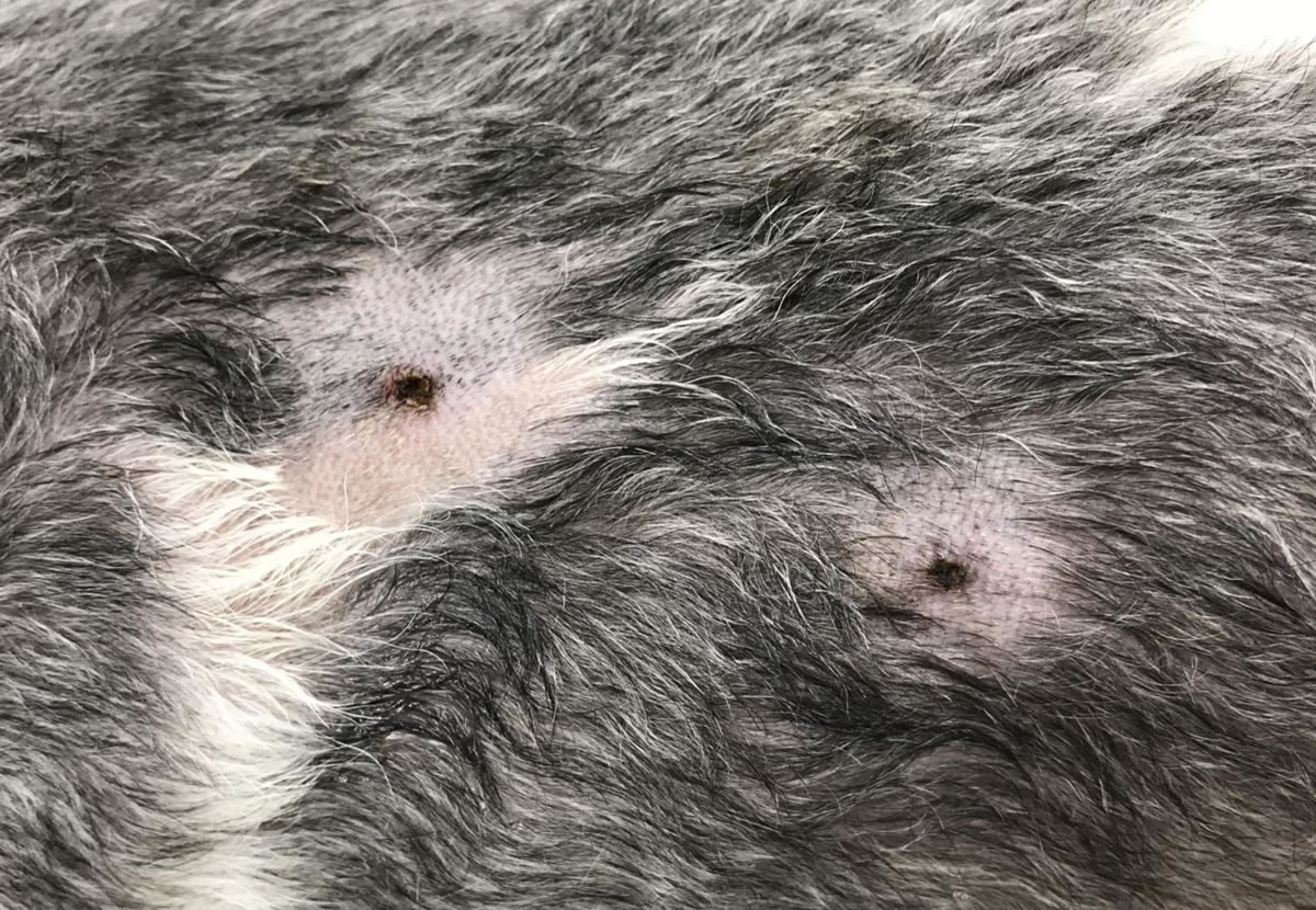 多発したイボ(良性)手術後