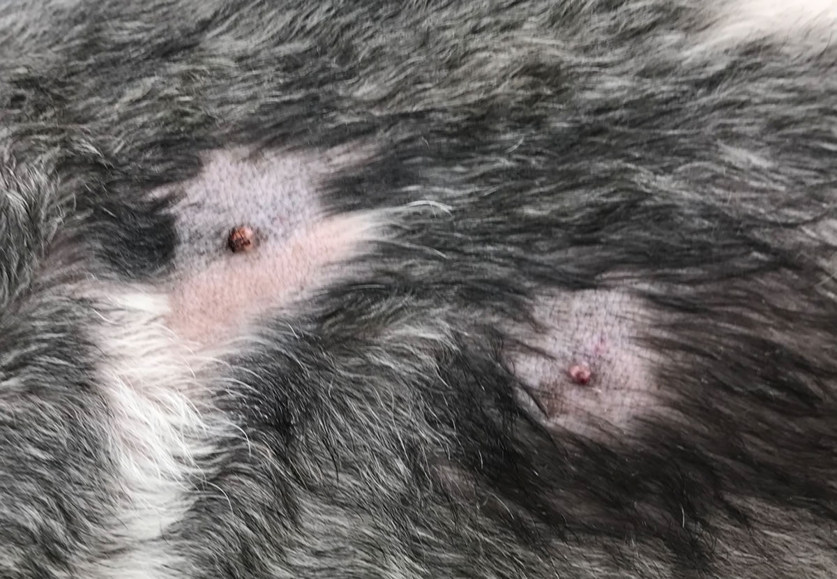 多発したイボ(良性)手術前