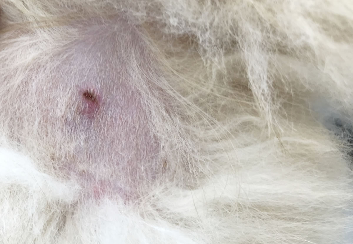 ④皮膚の下の粉瘤手術後