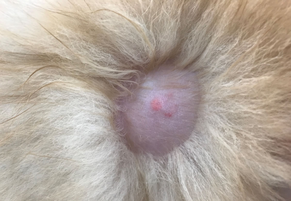 皮膚の下の粉瘤 手術前